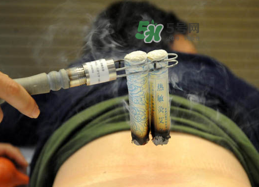 三伏天艾灸后能吹空調(diào)嗎？三伏天艾灸后能吹電扇嗎？