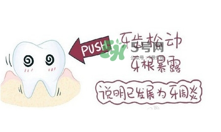 牙齒松動會自己好嗎？牙齒松動會自己掉嗎