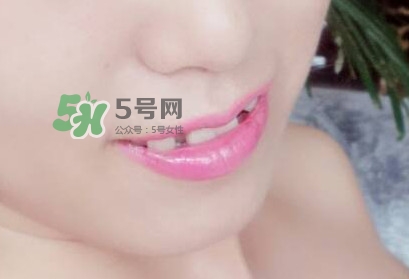 牙齒縫隙大怎么辦？牙縫大帶牙套有用嗎