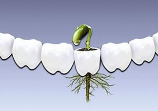 種植牙多少錢一顆？為什么種植牙很貴