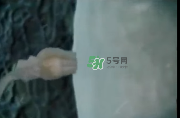 懷孕初期怎么保胎？陰道出血是流產(chǎn)征兆嗎？