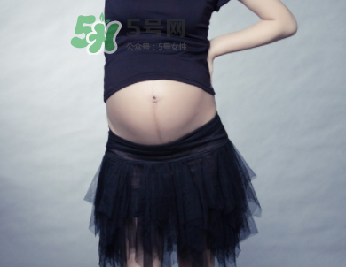 頭胎有妊娠線二胎沒有是因為寶寶性別不一樣嗎？