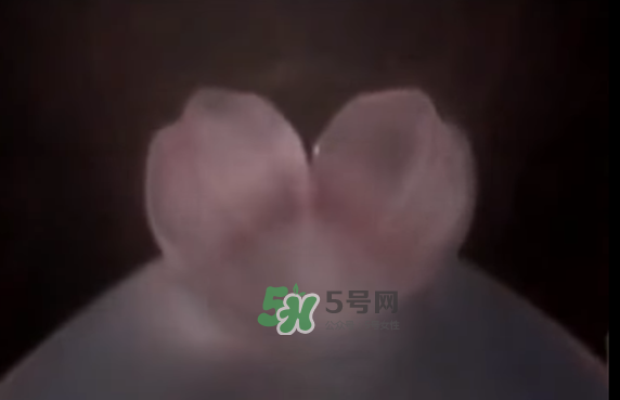 懷孕初期怎么保胎？陰道出血是流產(chǎn)征兆嗎？