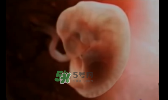 懷孕初期怎么保胎？陰道出血是流產(chǎn)征兆嗎？