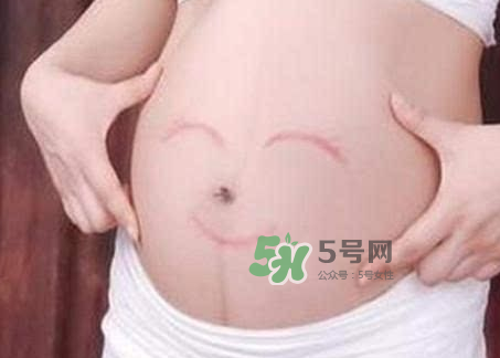 產(chǎn)婦胃脹氣怎么緩解？產(chǎn)婦胃脹氣怎么辦？