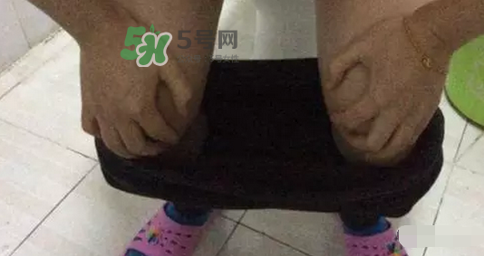 孕期可以蹲著上廁所嗎？孕期上廁所會(huì)壓到寶寶嗎？