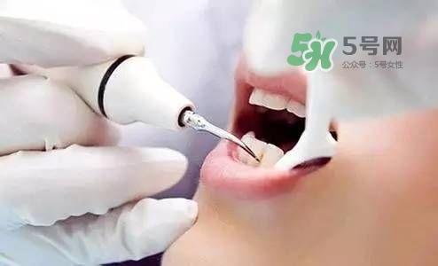 孕婦能矯正牙齒嗎？懷孕期間可以矯正牙齒嗎？