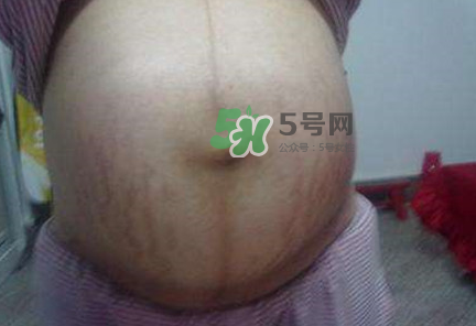懷女孩肚子上會(huì)長(zhǎng)毛嗎？懷女孩肚子特征圖片