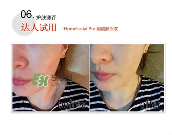 homefacialpro煙酰胺原液怎么樣？hfp煙酰胺原液好用嗎