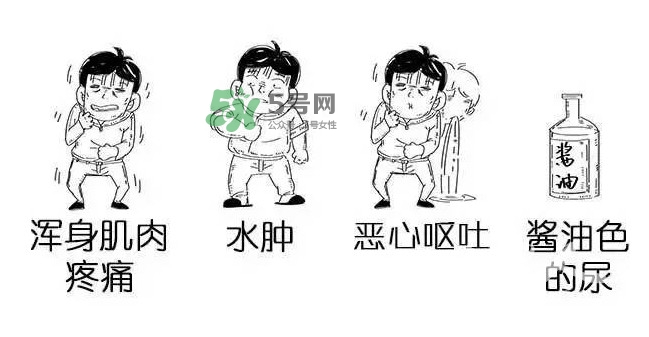 吃小龍蝦什么會(huì)得橫紋肌溶解癥？橫紋肌溶解癥嚴(yán)重嗎