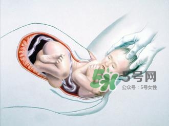 順產(chǎn)和剖腹產(chǎn)哪個(gè)好？順產(chǎn)和剖腹產(chǎn)哪個(gè)痛？