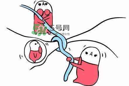 結(jié)扎好還是上環(huán)好？結(jié)扎上環(huán)哪個危害小？