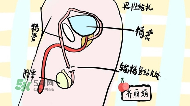 生完二胎一定要結扎嗎？生完二胎結扎好不好？
