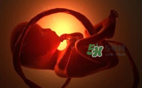 寶寶臍帶繞頸只能剖腹產(chǎn)嗎？胎兒臍帶繞頸孕婦有什么感覺(jué)