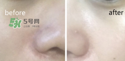 hr綠寶瓶新肌水怎么用？赫蓮娜綠寶瓶新肌水使用方法