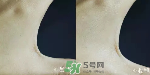 小黑瓶和小棕瓶可以一起用嗎？小棕瓶和小黑瓶哪個先用