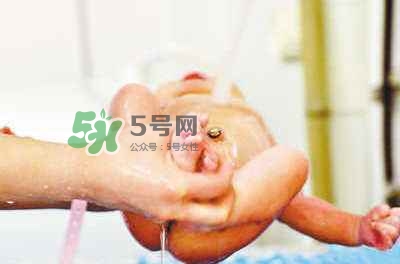 羊水栓塞是醫(yī)療事故嗎？羊水栓塞多發(fā)生于順產(chǎn)還是剖腹產(chǎn)？