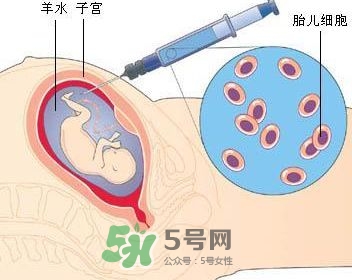 羊水栓塞是怎么回事？羊水栓塞怎么預(yù)防？