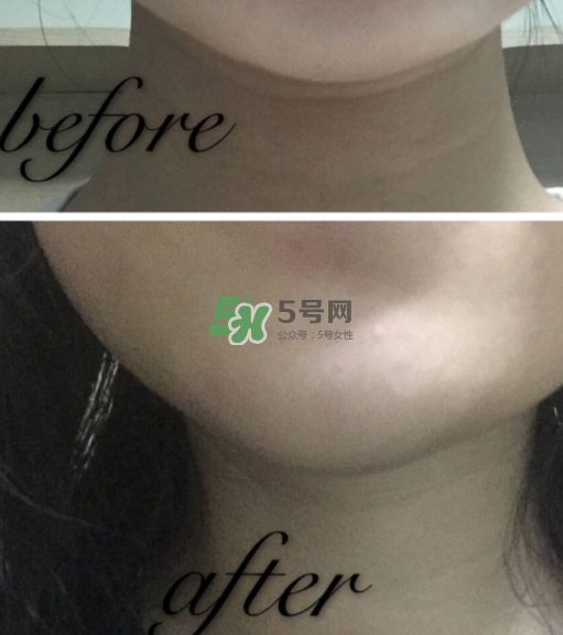 olay小白瓶有哪些版本？olay小白瓶版本區(qū)別