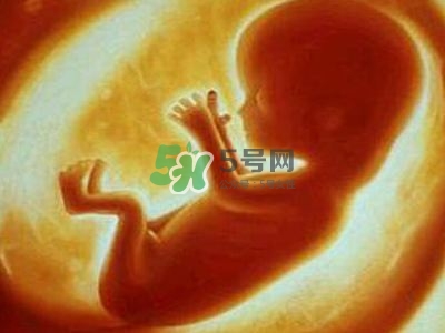 臍帶繞頸是什么原因造成的？臍帶繞頸是多休息還是多運動？