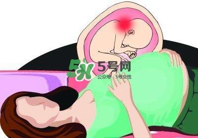 孕婦左側(cè)臥睡不著怎么辦？孕期左側(cè)睡不舒服怎么辦？