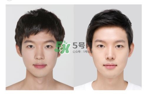 美白針有副作用嗎？美白針有什么副作用？