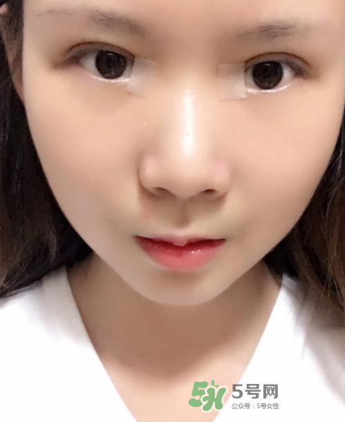 美皮護去疤效果怎么樣？美皮護有用嗎？