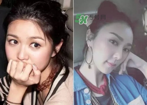 發(fā)際線低怎么調(diào)整？標(biāo)準(zhǔn)的發(fā)際線圖片