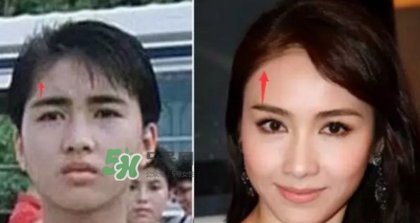 發(fā)際線低怎么調(diào)整？標(biāo)準(zhǔn)的發(fā)際線圖片