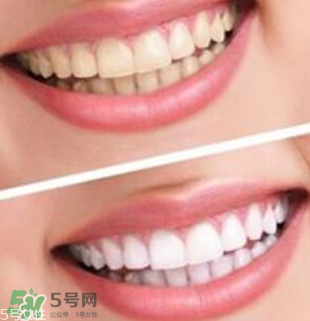 碧緹福美牙儀對(duì)牙齒有傷害嗎？碧緹福美牙儀會(huì)反彈嗎？