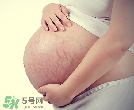 孕婦胸部長妊娠紋嗎？胸部長妊娠紋了怎么辦？