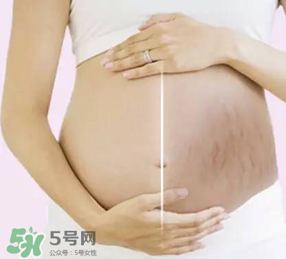 長(zhǎng)妊娠紋的前兆 長(zhǎng)妊娠紋很癢怎么辦？