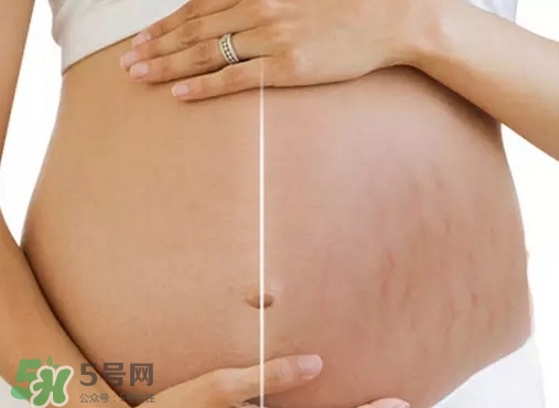 脖子上會長妊娠紋嗎？妊娠紋長在哪些地方？
