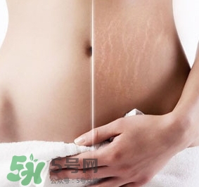 妊娠紋什么時(shí)候變白？妊娠紋產(chǎn)品什么時(shí)候用？