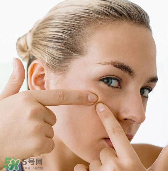 長痘長閉口怎么辦？長痘長閉口是什么原因？
