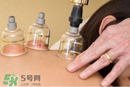 真空拔罐有用嗎？真空拔罐多長時間合適
