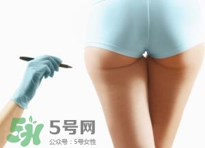 吸脂減肥副作用有哪些？吸脂減肥可靠嗎？