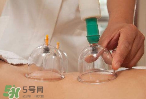 真空拔罐有用嗎？真空拔罐多長時間合適