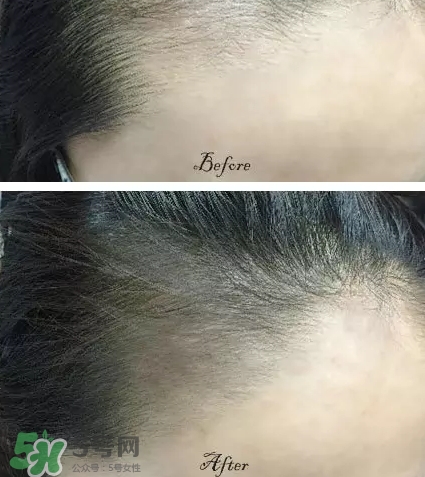 發(fā)際線粉要卸妝嗎_怎么卸？