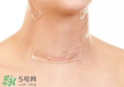 硅膠疤痕貼有用嗎？硅膠疤痕貼效果怎么樣？