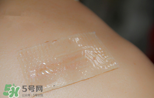 仙卡疤痕貼有用嗎？仙卡疤痕貼效果怎么樣？