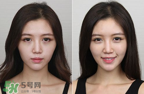 蘋果肌怎么化？蘋果肌究竟哪里好？