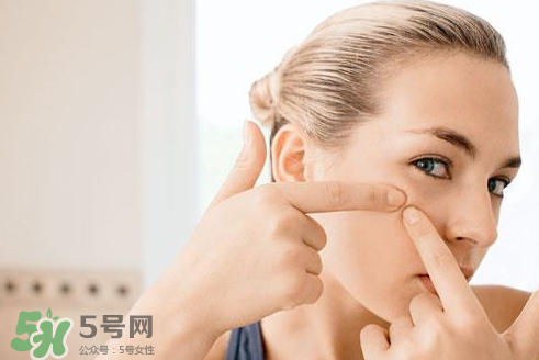 暗瘡可以擠壓嗎？油性和骯臟肌膚會容易有暗瘡嗎？