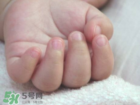 寶寶手指甲有白痕怎么回事？幼兒手指甲發(fā)白是缺鈣嗎