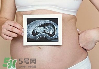 雙子宮可以上環(huán)嗎？雙子宮上環(huán)要注意哪些？