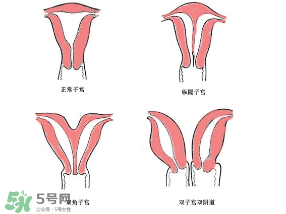 雙子宮是什么意思？雙子宮可以順產(chǎn)嗎？
