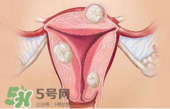 雙子宮可以上環(huán)嗎？雙子宮上環(huán)要注意哪些？
