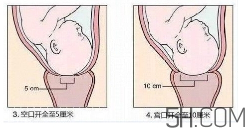 內(nèi)檢是什么感覺？內(nèi)檢有男醫(yī)生嗎？