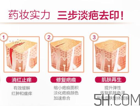ISDIN怡思丁祛疤膏怎么用？ISDIN怡思丁祛疤膏使用說明