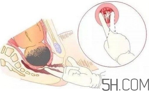 內(nèi)檢是什么感覺？內(nèi)檢有男醫(yī)生嗎？